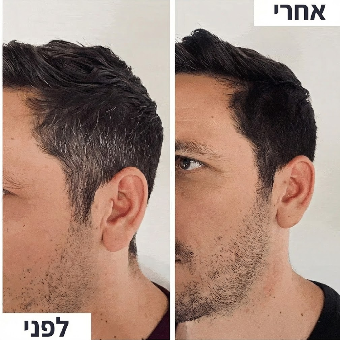 תוצאות בפחות מ-6 שבועות