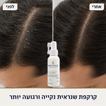 Revivex - פתרון להקלה מיידית בקשקשים גירודים ואדמומיות