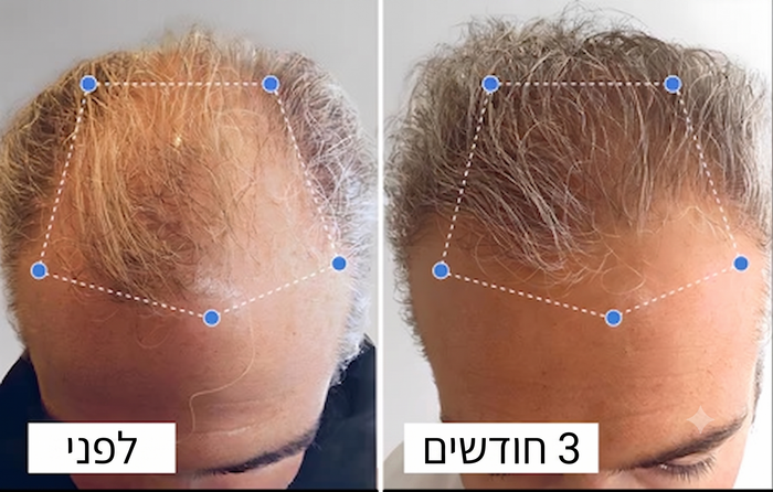 צמיחה נראית תוך 90 יום או כספך בחזרה