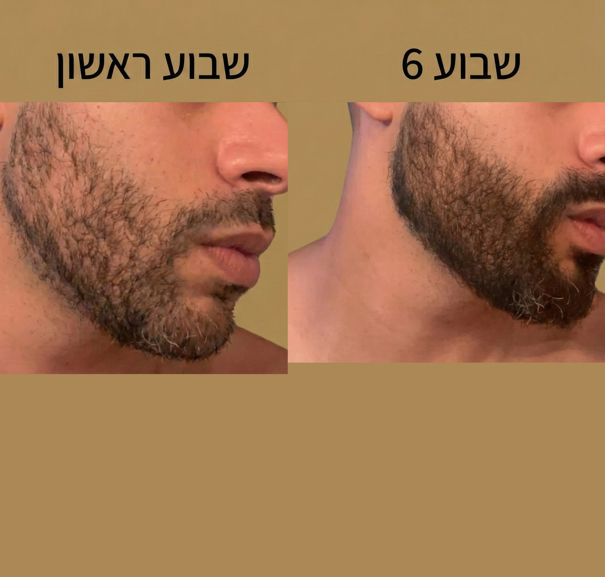 זה גם עוזר למצב הזקן, לא רק לצבע