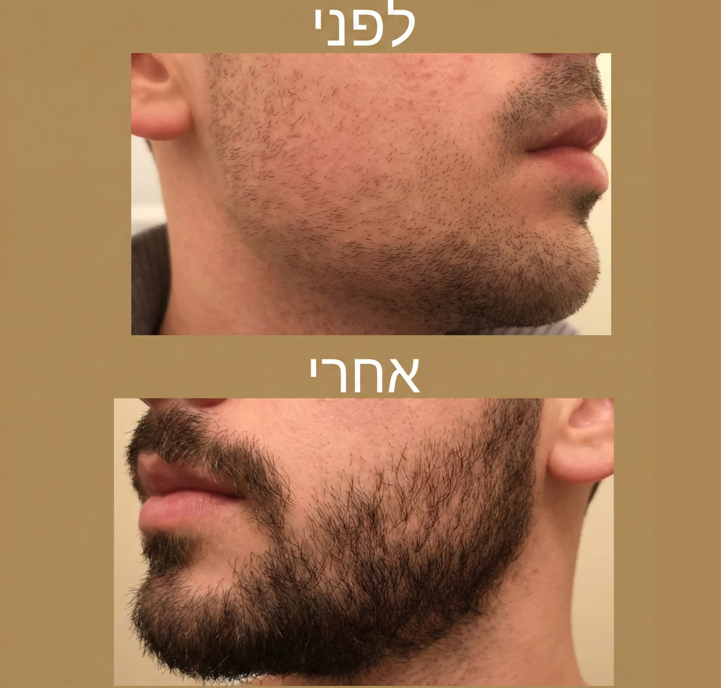 Revivex - רולר סרום לצמיחת שיער