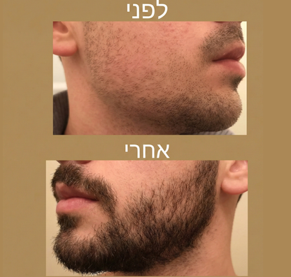Revivex - רולר סרום לצמיחת שיער