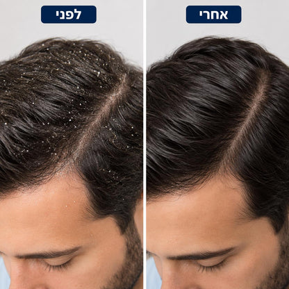 Revivex - פתרון להקלה מיידית בקשקשים גירודים ואדמומיות